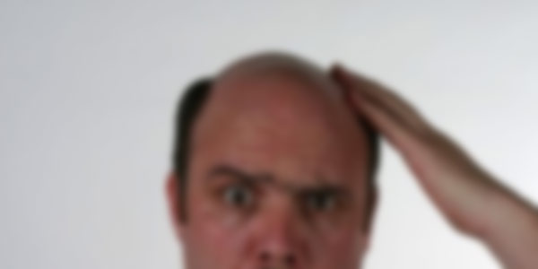Средство от облысения
